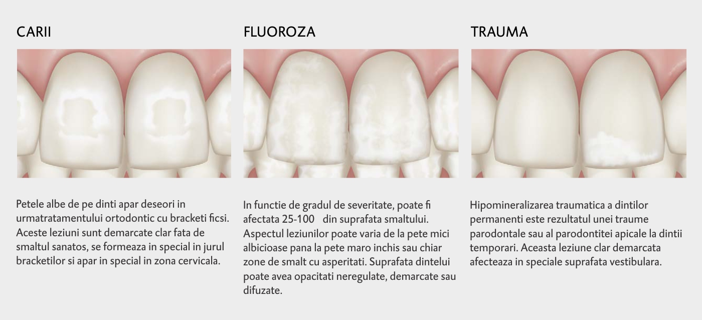 ICON VESTIBULAR